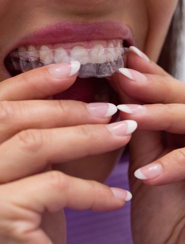Close-up of female patient wearing braces in dental clinic
